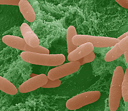 Photo: Colorized scanning electron micrograph of pathogenic E. coli on a lettuce leaf. Image is shown at about 16,000 times normal size. Link to photo information